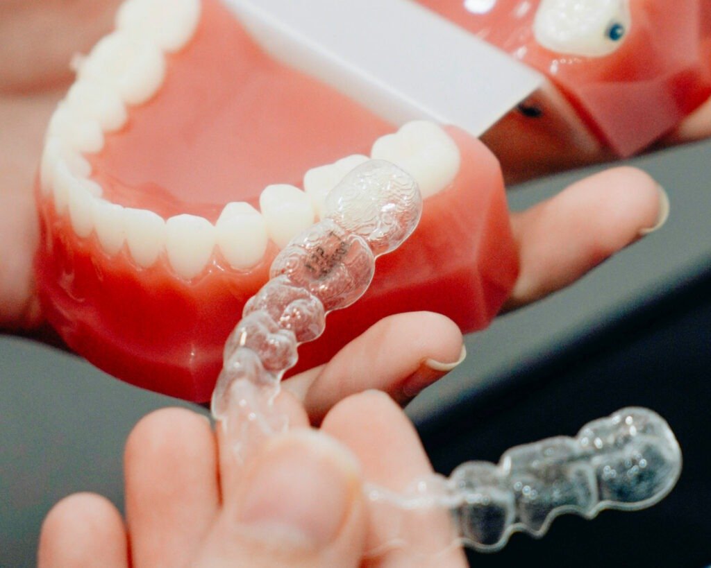 Everything You Need to Know about Retainers