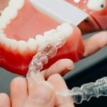 Everything You Need to Know about Retainers